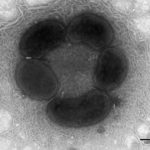 Viral particle in equine feces